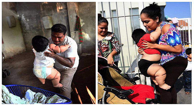 Conoce el conmovedor caso del bebé de 10 meses que pesa 28 kilos (FOTOS)