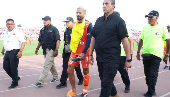 Paolo Guerrero salió sentido del partido ante Sport Boys en el Callao. (Foto: Jesus Saucedo / GEC)