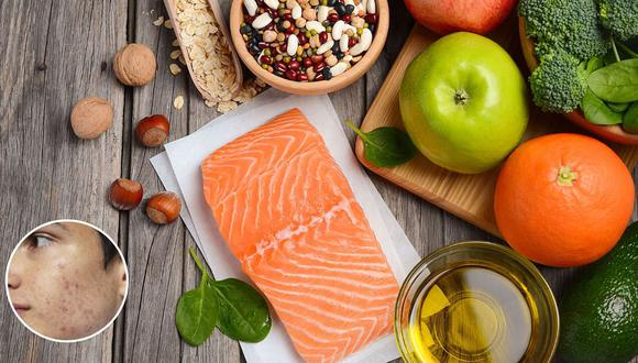 Aunque los estudios no muestran un consenso que valide categóricamente qué alimentos causan acné, muchas personas que padecen condición notan cómo empeoran al consumir ciertos alimentos.