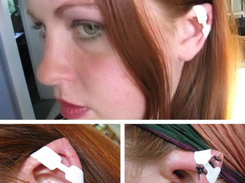 Orejas de Elfo son lo último en la moda de cirugías 