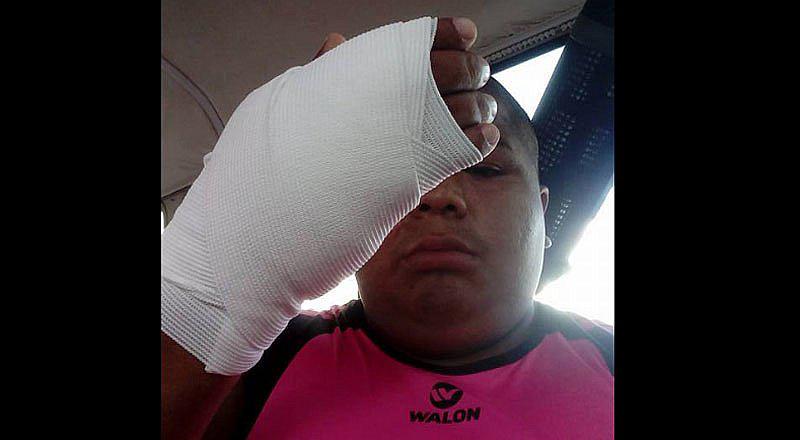 ¿Mayimbú es atropellado en Chancay? Esta foto te sorprenderá  