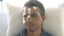 Policía herido durante protesta: “Nos lanzaron una granada, pudo habernos matado a todos”