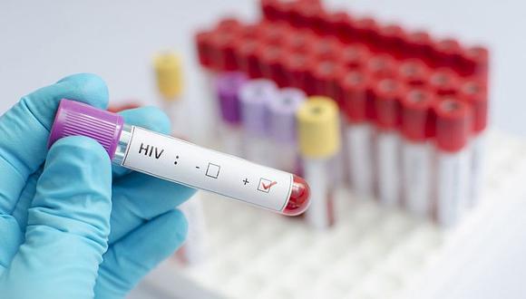 Descubren chip que detecta el VIH en la primera semana de infección 