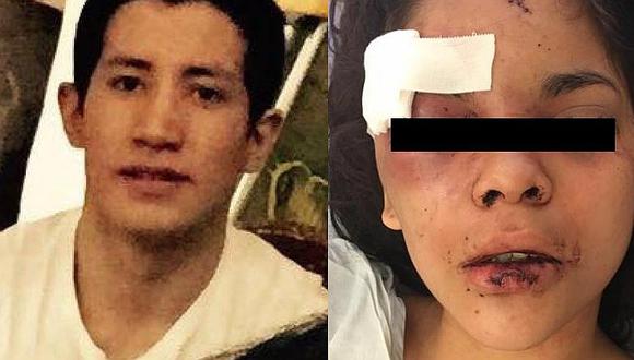 ​Cajamarca: Hombre que golpeó a su pareja se entregó a las autoridades