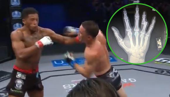 Luchador de MMA pelea con el dedo roto y gana el combate (VIDEO)