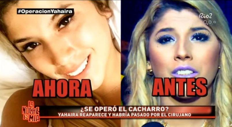 ​Yahaira Plasencia llegó transformada: Se habría hecho estas cirugías en Brasil