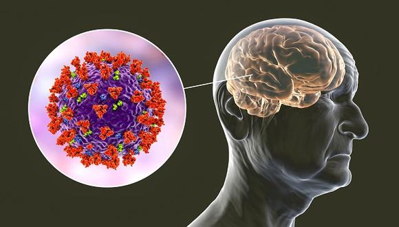 No se sabe si los cambios por el coronavirus son permanentes en el cerebro. Ojalá que se reviertan.
