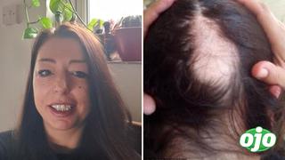 Mujer se da cuenta que tuvo COVID-19 cuando comenzó a perder grandes mechones de cabello 