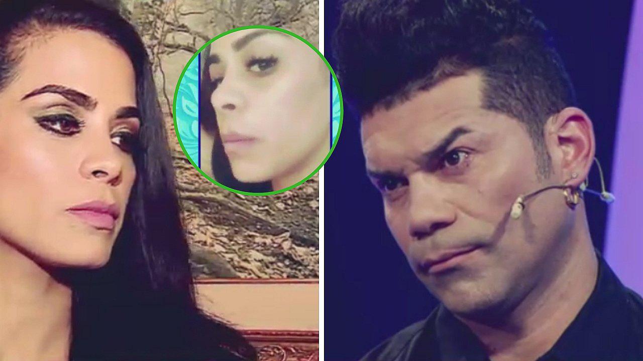 Vanessa López muestra golpes que le habría propinado 'Tomate' Barraza (FOTOS)