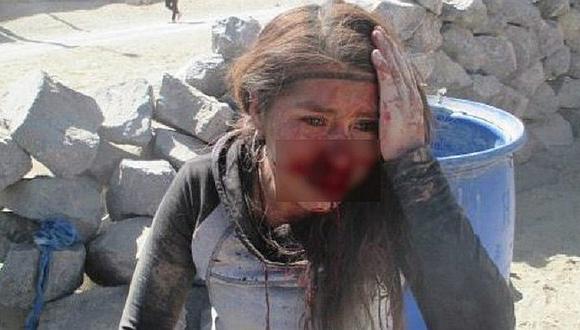 Arequipa: Joven denuncia brutal golpiza de su pareja y hasta intento de violación 