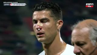 Cristiano Ronaldo recibió un golpe por el que terminó con el rostro ensangrentado en la UEFA Nations League | VIDEO