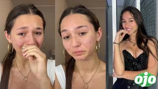 Alexia Barnechea estalla en llanto por acné crónico y preocupa a fans: “Hay algo que no está bien”