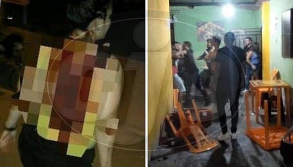 Extranjera es atacada brutalmente por peruano armado con pico de botella en un bar