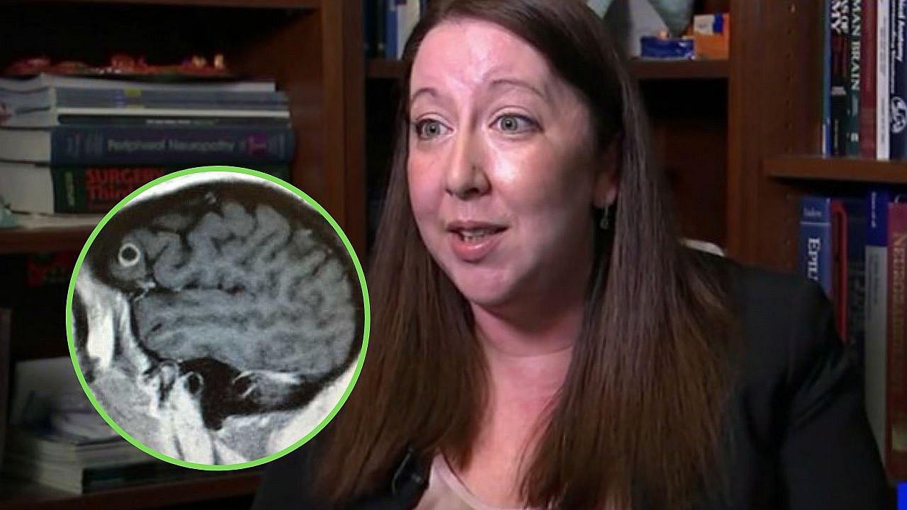 Mujer es diagnosticada con cáncer en el cerebro, pero descubren que tenía un gusano
