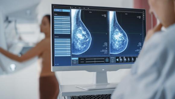La iniciativa Semáforo Oncológico indicó que el objetivo es que los municipios brinden el servicio de mamografía de manera gratuita a todas las mujeres de 50 a 69 años.