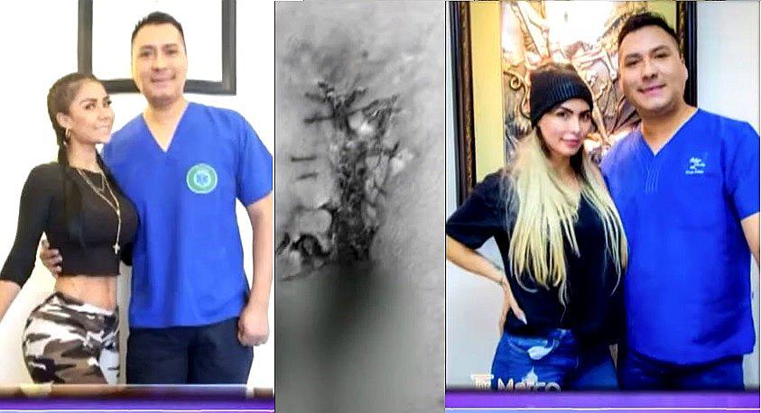 ​Doce mujeres denuncian a "cirujano de las estrellas" de haberlas desfigurado │VIDEO