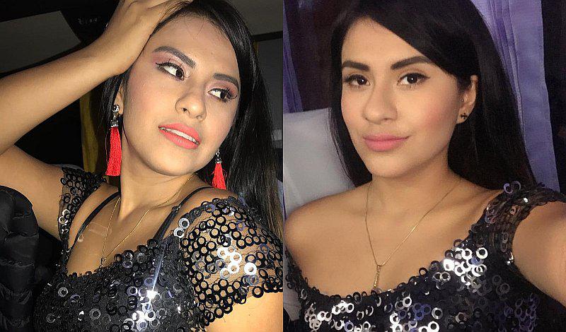 Thamara Gómez mostró cómo quedó su nueva nariz luego de operarse