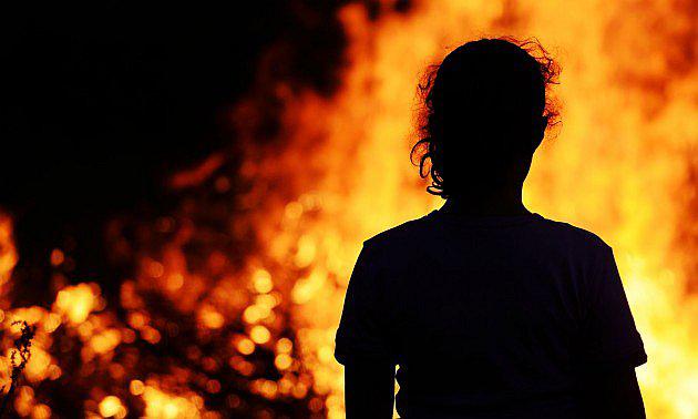 Mujer es declarada muerta por quemaduras en 90% de su cuerpo, pero revive hora y media después