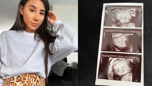 Samahara Lobatón compartió nueva ecografía de su embarazo. (Instagram)