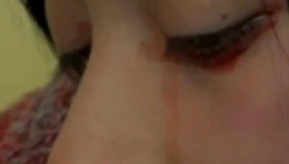 Mujer que llora sangre causa impacto en Chile [VIDEO]