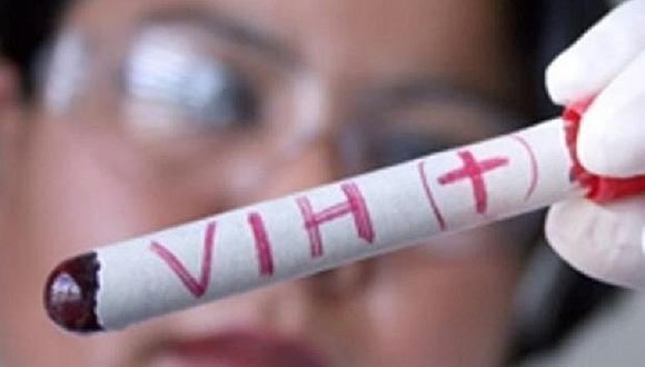 Investigadores descubren formula para eliminar el virus del VIH
