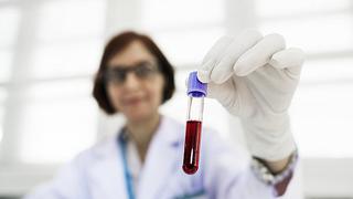 Inventan nuevo test que detecta hasta siete tipos de cáncer con solo una muestra de sangre