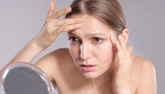 8 formas prácticas de eliminar el acné en la etapa adulta 