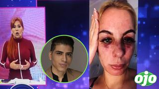 Dalia Durán termina con el rostro desfigurado tras presunta agresión de John Kelvin | VIDEO 