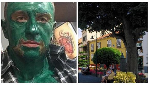 Hombre viaja de Italia a España y lanza ácido a su expareja (FOTO)