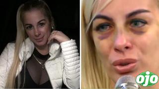 Dalia Durán revela que su familia está “destrozada” tras conocer que fue agredida por John Kelvin | VIDEO  