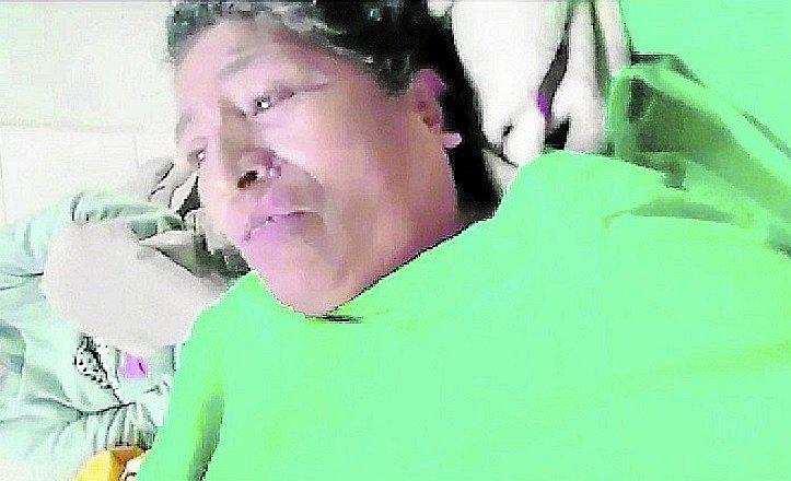 Ate: Mujer no puede caminar por golpiza de su esposo miembro de serenazgo 