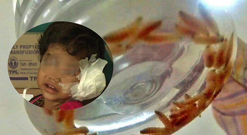 Extraen 80 gusanos del oído de una niña de cuatro años     