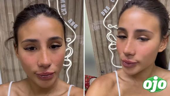 Samahara Lobatón y sus nuevos retoques en la cara con canje | Imagen compuesta 'Ojo'
