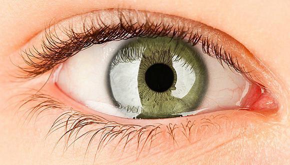 6 Remedios Caseros Para Ojos Llorosos Y O Remedios Para El Dolor De Los Ojos Mujer Ojo