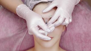Mujer se aplica inyecciones faciales y termina con media cara paralizada
