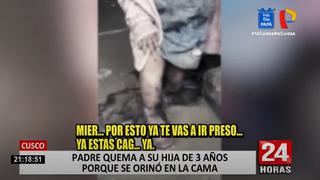 Niña de 3 años es quemada con teja calientes por su padre tras orinarse en la cama | VIDEO