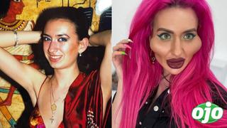 “Me sentía fea”: El ‘antes y después’ de la modelo con las mejillas más grandes del mundo | FOTOS