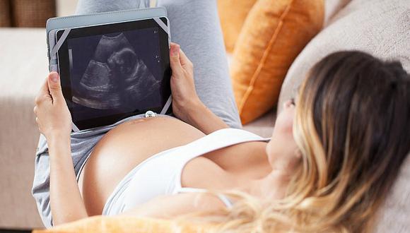 ¿Quieres ver la ecografía de tu bebé en tu smartphone? ¡Ahora es posible! 