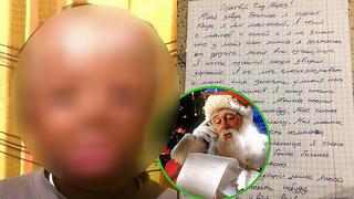 Niño de cinco años escribe emotiva carta a Papá Noel: "quiero una cara nueva"