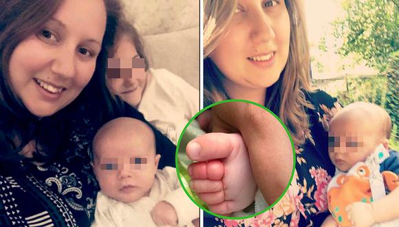 Bebé casi pierde el dedo por quedar enredado con cabello de su madre