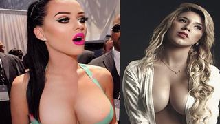 ​Yahaira Plasencia y Katy Perry tienen en común este problema dental