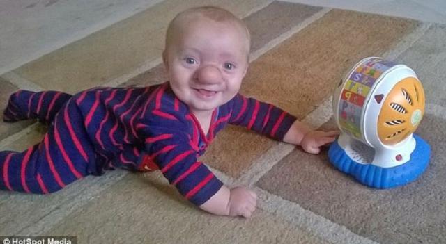 ​Esta es la conmovedora historia del "pinocho de la vida real" [FOTOS]