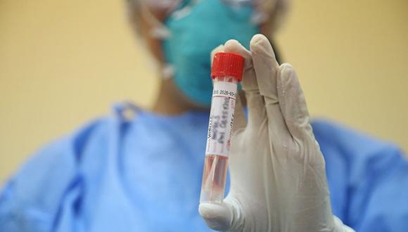 La autoridades de Salud de Loreto informaron que tras analizar 27 muestras de hisopado, 18 fueron descartadas y 9 confirmados.
