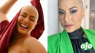 Natalia Salas muestra sus cicatrices tras mastectomía: “más fuerte de lo que pensaba” | FOTO