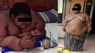 Obesidad mórbida: Conoce el caso de un niño de 10 años que pesa 192 kilos 