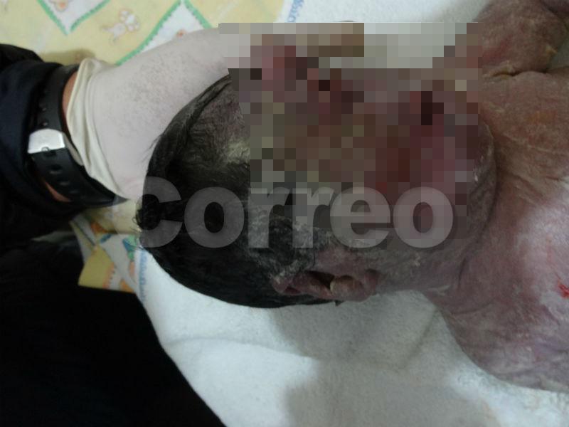 Huancavelica: Nace niño cíclope y sólo vive 40 minutos 