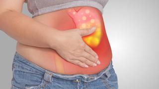 Cáncer de estómago: ¿Cuáles son sus síntomas y cómo prevenirlo?