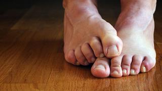 La columna de Pérez Albela: Proteja sus pies en verano si es diabético