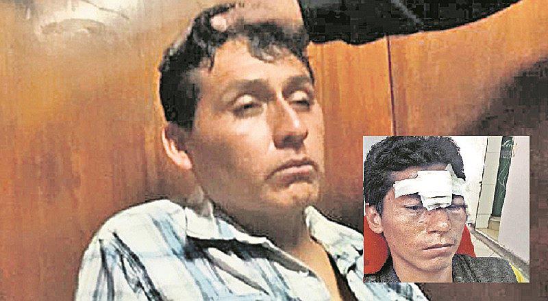 Ate: Ebrio atropella a mototaxista y se hace pasar por PNP para no ser detenido