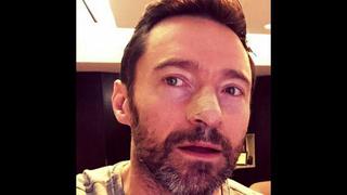 Hugh Jackman es operado por quinta vez de cáncer de piel